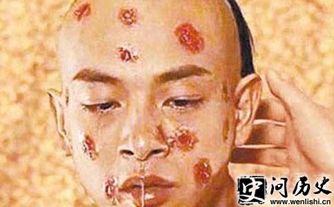 同治身患天花
