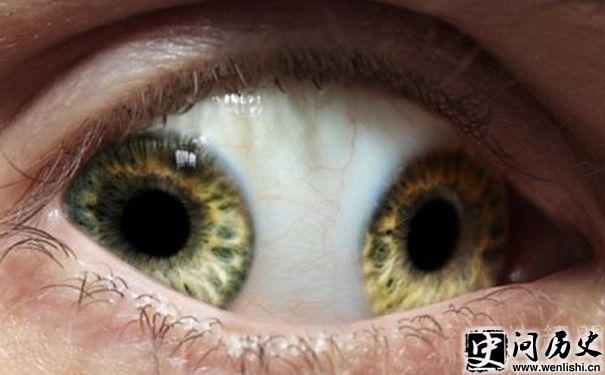 ˫ͫ