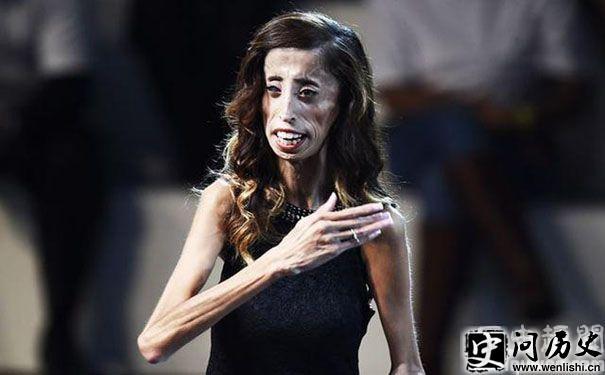 Lizzie Velasquez