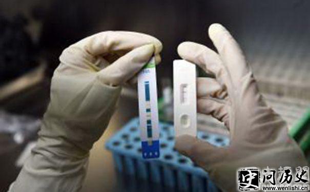 HIV