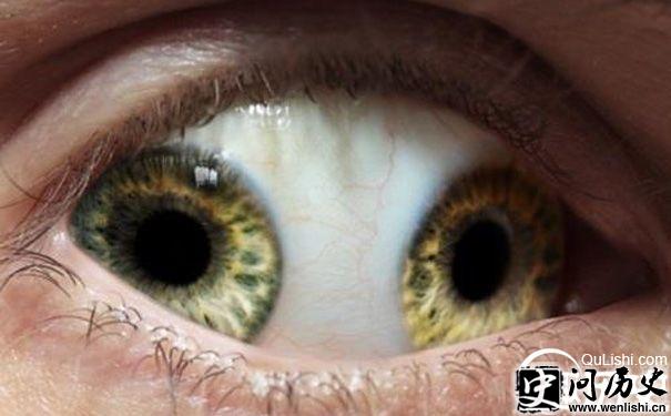 双瞳