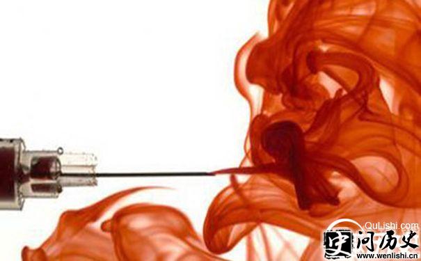 输入年轻人血液能变年轻吗