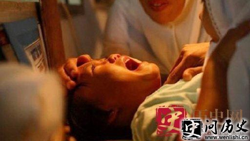 割礼
