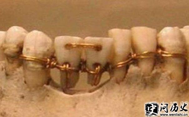 ľ