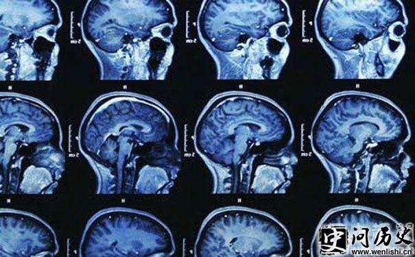 MRI Գ