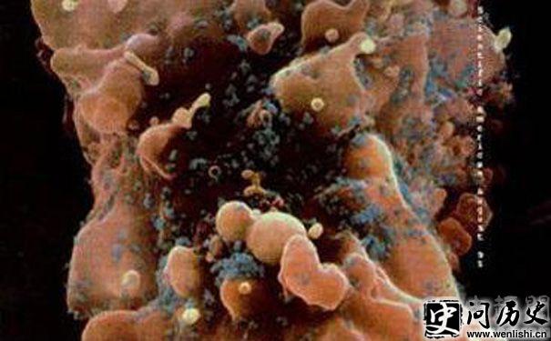 HIV