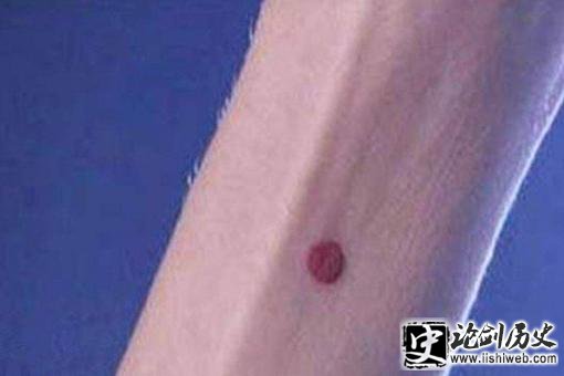 守宫砂是什么真的吗?守宫砂真正用处是什么? 守宫砂是什么真的吗?守宫砂真正用处是什么?