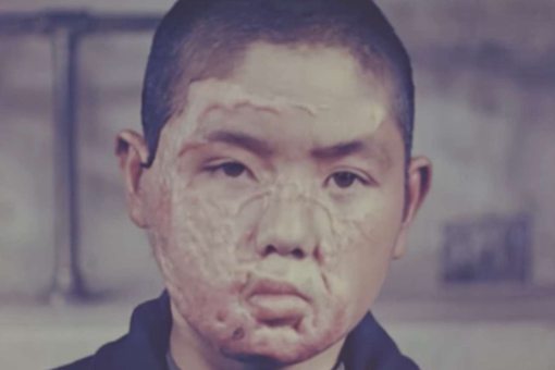 广岛长崎原爆后有什么影响 其后果有多严重 广岛长崎原爆后有什么影响 其后果有多严重